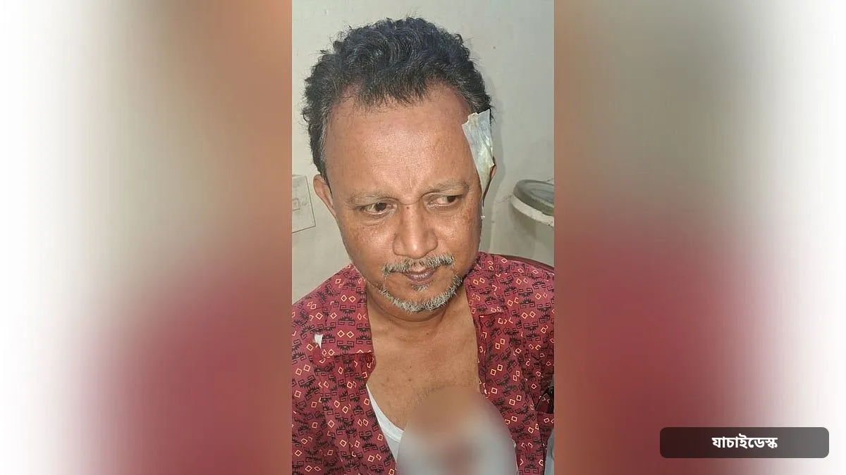 চুল কাটতে বলায় পরীক্ষার হলে কলম দিয়ে শিক্ষককে রক্তাক্ত করল নবম শ্রেণির ছাত্র